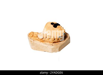 Prothèse partielle montée sur un modèle d'étude en plâtre et placée sur un fond blanc Banque D'Images