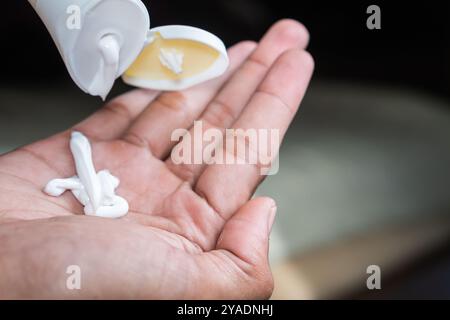 Une personne pressant la lotion d'un tube sur sa main. Banque D'Images