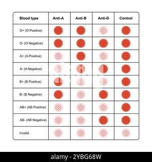 Groupes sanguins ABO, illustration. Banque D'Images