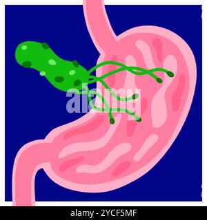 Illustration vectorielle Helicobacter pylori. Estomac dessiné à la main, bactéries. Image médicale informative lumineuse. Maladie de l'estomac, duodénum, œsophage Illustration de Vecteur