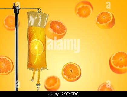 La vitaminothérapie intraveineuse. Ensemble d'infusion IV et oranges tombantes sur fond doré Banque D'Images