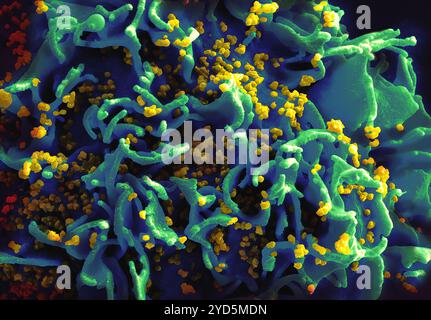 Micrographie électronique à balayage d'une cellule T humaine H9 (bleu/vert) infectée par des particules du virus VIH (jaune). Banque D'Images