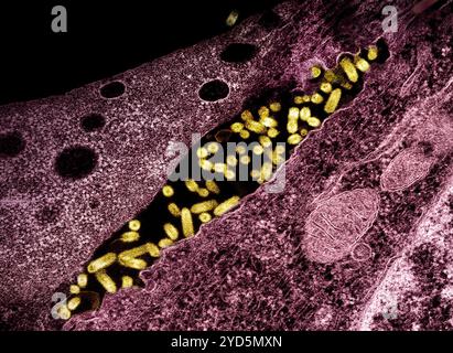 Micrographie électronique à transmission montrant des particules (jaunes) du virus de la stomatite vésiculeuse (VSV) bourgeonnant à partir de cellules infectées (Bordeaux). Banque D'Images