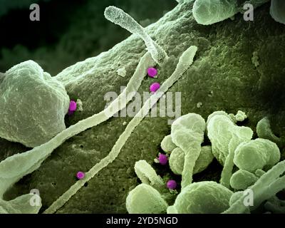 Micrographie électronique à balayage colorisé des particules (roses) du virus de la fièvre hémorragique de Crimée-Congo (CCHF) bourgeonnant à la surface de cultures. Banque D'Images