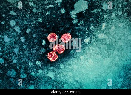 1981 Dr Erskine Palmer cette micrographie électronique par transmission (met) a révélé la présence de virions de l'hépatite B. Banque D'Images