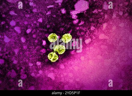 1981 Dr Erskine Palmer cette micrographie électronique par transmission (met) a révélé la présence de virions de l'hépatite B. Banque D'Images