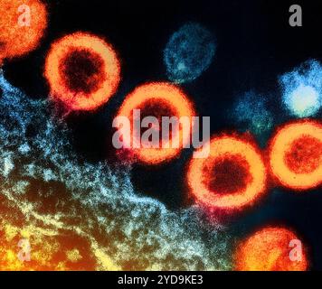 Micrographie électronique par transmission des particules de virus VIH-1 orange répliquant à partir de la membrane plasmique d'une cellule T H9 infectée. Virus VIH-1 016867 216 Banque D'Images