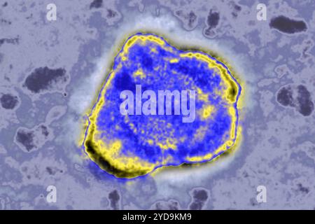 Virus de l'herpès HSV. HSV est la cause des boutons de froid, de l'herpès génital, de la varicelle, de la mononucléose infectieuse, de la roséole, parfois des bardeaux. Ils sont impliqués dans certains cancers dont le lymphome de Burkitt. Image de microscopie électronique. Virus de l'herpès 016836 018 Banque D'Images