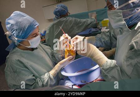 Un chirurgien et son équipe réalisant une intervention chirurgicale sur la poitrine d un patient. Chirurgien. 016847 001 Banque D'Images