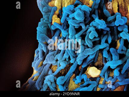 Micrographie électronique à balayage colorisé des particules de virus de Marburg bleues à la fois bourgeonnant et attachées à la surface d'une cellule VERO E6 infectée or. Particules du virus de Marburg 016867 009 Banque D'Images