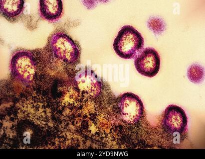 Micrographie électronique par transmission des particules du virus VIH-1 colorées en rose/jaune se répliquant à partir d'un lymphocyte T H9 infecté par le VIH brun. Particules du virus VIH-1 016867 033 Banque D'Images