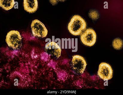 Micrographie électronique par transmission des particules du virus VIH-1 colorées en jaune se répliquant d'un lymphocyte T H9 infecté par le VIH en rose. Particules du virus VIH-1 016867 034 Banque D'Images
