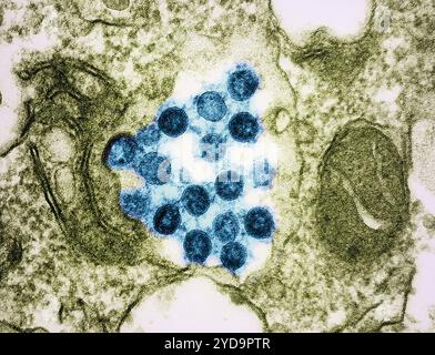 Micrographie électronique en transmission des particules du virus SARS-CoV-2 colorées en bleu, isolées d'un échantillon de patient. Nouveau coronavirus SARS-CoV-2 Omicron 016867 105 Banque D'Images