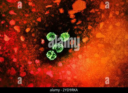 1981 Dr Erskine Palmer cette micrographie électronique par transmission met a révélé la présence de virions de l'hépatite B. Les grands virions ronds sont connus sous le nom de particules Dane. Voir PHIL 10755, pour une version colorisée de cette image. Hépatite signifie inflammation du foie. Les toxines, certains médicaments, certaines maladies, la consommation excessive d'alcool et les infections bactériennes et virales peuvent toutes causer l'hépatite. L'hépatite est aussi le nom d'une famille d'infections virales qui affectent le foie les types les plus communs aux États-Unis sont l'hépatite A, l'hépatite B, et l'hépatite C. virus de l'hépatite B 016867 203 Banque D'Images