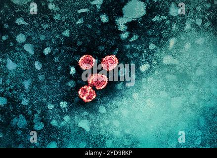 1981 Dr Erskine Palmer cette micrographie électronique par transmission met a révélé la présence de virions de l'hépatite B. Les grands virions ronds sont connus sous le nom de particules Dane. Hépatite signifie inflammation du foie. Les toxines, certains médicaments, certaines maladies, la consommation excessive d'alcool et les infections bactériennes et virales peuvent toutes causer l'hépatite. L'hépatite est aussi le nom d'une famille d'infections virales qui affectent le foie les types les plus courants sont l'hépatite A, l'hépatite B et l'hépatite C. virus de l'hépatite B 016867 202 Banque D'Images
