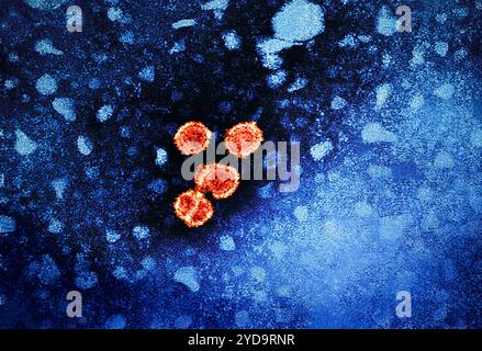 1981 Dr Erskine Palmer cette micrographie électronique par transmission met a révélé la présence de virions de l'hépatite B. Les grands virions ronds sont connus sous le nom de particules Dane. Hépatite signifie inflammation du foie. Les toxines, certains médicaments, certaines maladies, la consommation excessive d'alcool et les infections bactériennes et virales peuvent toutes causer l'hépatite. L'hépatite est aussi le nom d'une famille d'infections virales qui affectent le foie les types les plus courants sont l'hépatite A, l'hépatite B et l'hépatite C. virus de l'hépatite B 016867 201 Banque D'Images