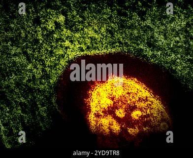 Cette micrographie électronique en transmission met a révélé l'aspect ultrastructural d'une particule virale, ou virion, du virus de la rougeole. Particule du virus de la rougeole 016867 350 Banque D'Images