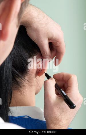 Le chirurgien plastique examine l'oreille du patient avant la chirurgie plastique Banque D'Images