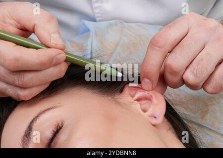 Le chirurgien plastique examine l'oreille du patient avant la chirurgie plastique Banque D'Images