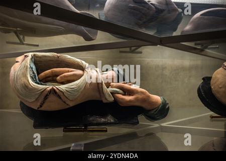 Un modèle en terre cuite au Museo di Palazzo Poggi montre un avant-bras disséqué avec les muscles de la main exposés, deux doigts levés. L’exemplaire est l’un des modèles anatomiques d’enseignement que l’Université de Bologne utilisait pour former les étudiants en médecine au XVIIIe siècle. Piazza Antonio Scaravilli, Bologne, Émilie-Romagne, Italie. Banque D'Images