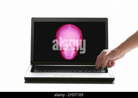 Rayons X sur le moniteur Banque D'Images