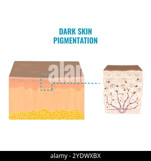 Mécanisme de pigmentation du teint de la peau dans la peau sombre Illustration de Vecteur