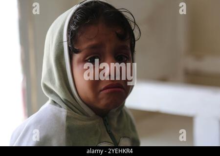 Les amputés à la suite de la guerre au Yémen reçoivent des prothèses dans un hôpital de la ville yéménite de Taiz Banque D'Images