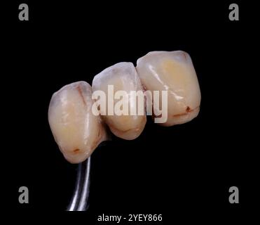 Céramique couronnes avant fini, un fond noir Banque D'Images