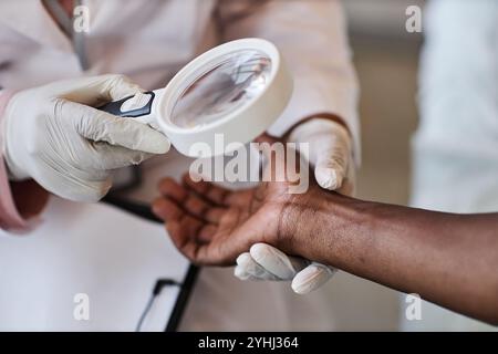 Vue de dessus gros plan du dermatologue inspectant soigneusement les bras du patient méconnaissable en clinique et en utilisant l'espace de copie de loupe Banque D'Images