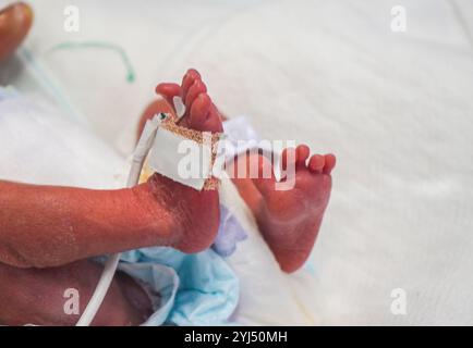 Vue rapprochée d'un bébé prématuré dans l'incubateur et tenu par une mère aimante Banque D'Images