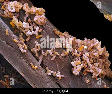 Bactéries Salmonella. Micrographie électronique à balayage couleur (MEB) des bactéries Salmonella. Des flagelles, des structures minces en forme de fils utilisées par les bactéries pour se déplacer, sont également visibles. La bactérie Salmonella peut causer une intoxication alimentaire lorsqu'elle est consommée dans des aliments contaminés comme les œufs crus. Dans les bonnes conditions, ils peuvent se multiplier rapidement. Les symptômes comprennent des douleurs abdominales, des nausées, des diarrhées et des vomissements. La typhoïde est également causée par une bactérie Salmonella typhi. Grossissement : x5000 lorsqu'il est imprimé à 10cm de large. Banque D'Images