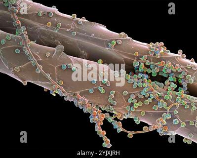 Spores fongiques. Micrographie électronique à balayage coloré (MEB) des spores d'un champignon non identifié sur un poil de chat. Grossissement : x300 lors de l'impression à 10 centimètres de large. Banque D'Images