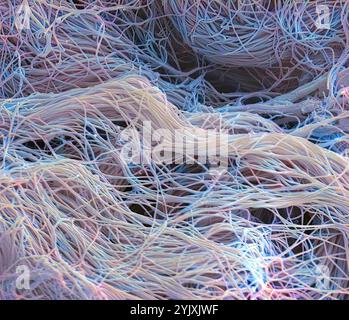 Tissu conjonctif. Micrographie électronique à balayage couleur (MEB) du collagène d'une polybiopsie nasale. Le collagène est une protéine à haute résistance à la traction, qui fournit structure et élasticité à l'épithélium, aux tendons, aux ligaments et aux os. C'est la protéine la plus abondante dans le corps. Dans le derme, le collagène forme des fibres semblables à des cordes qui sont disposées irrégulièrement. Grossissement : x1300 pour une impression de 10 centimètres de large. Banque D'Images