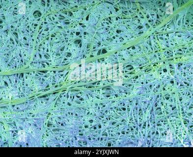 Brins de soie d'araignée. Micrographie électronique à balayage coloré (MEB) de brins de soie provenant de proies d'insectes piégés. La soie est également utilisée par de nombreuses araignées pour fabriquer des étuis à œufs. La soie d'araignée est faite d'un polymère protéique appelé fibroïne. Il est très élastique et peut être étiré de 30-40% de sa longueur avant de se casser. Grossissement : x1000 lors de l'impression de 10cm de large Banque D'Images