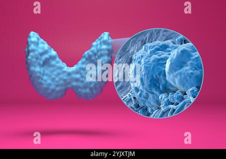 Cellules de cancer de la thyroïde - vue isométrique 3D illustration Banque D'Images