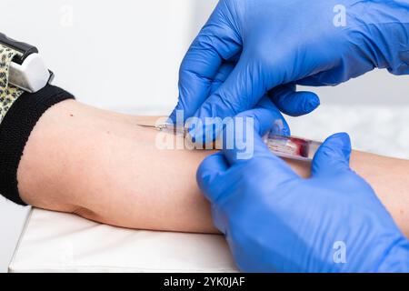 Un gros plan d'un travailleur de santé portant des gants prélève un échantillon de sang dans la veine du bras Banque D'Images