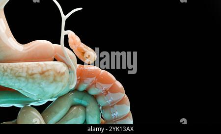 Calculs biliaires dans le canal biliaire, silhouette humaine et anatomie des organes environnants, foie et vésicule biliaire avec calculs, rendu réaliste 3D Banque D'Images