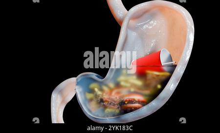 Estomac avec malbouffe, hamburger malsain et pizza et frites, surpoids et nutrition, anatomie du système digestif, alimentation médicale et de santé Banque D'Images