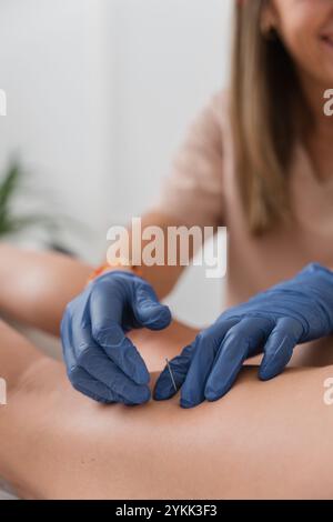 Physiothérapeute appliquant la technique d'aiguilletage à sec à la jambe du patient pour soulager la douleur Banque D'Images