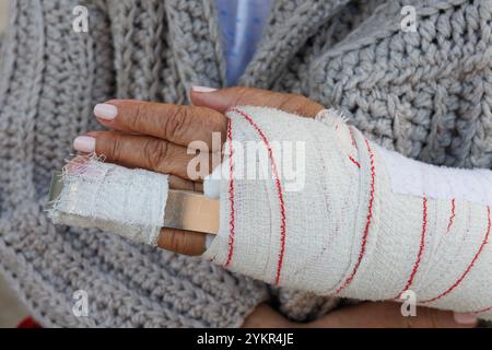 Bandage avec attelle pour immobiliser une fracture ou une blessure à l'annulaire Banque D'Images