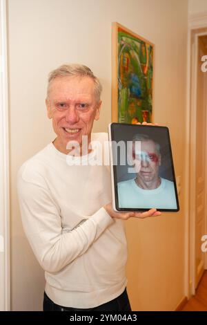 Dancer Against cancer calendrier DAC Shoot Charity Against cancer avec des célébrités, Hôtel Kaiserhof, Vienne, Autriche. 19 novembre 2024. Peter Stöger. - 20241119 PD11847 crédit : APA-PictureDesk/Alamy Live News Banque D'Images