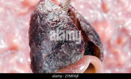 Pneumonie maladie, poumons sains et maladies poumons, cancer des poumons humains, fumeurs de cigarettes maladie pulmonaire, tumeur maligne cancéreuse en croissance et propagation Banque D'Images