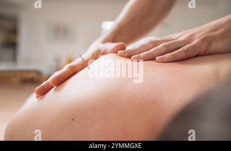 Les mains du thérapeute massent doucement le dos du patient pendant le traitement d'acupuncture à aiguilles fines. L'image met en valeur la relaxation, la médecine alternative, la voiture de santé Banque D'Images