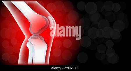Douleurs articulaires du genou. Vue latérale du genou humain. Maladie inflammatoire articulaire. Fond rouge foncé avec espace pour votre texte. Illustration vectorielle pour presentati Illustration de Vecteur