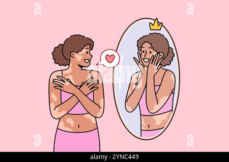 Femme atteinte du syndrome du vitiligo ou des taches sur la peau regarde dans le miroir et sourit, s'acceptant telle qu'elle est. Fille ethnique avec une haute estime de soi et la maladie de vitiligo ressent de la sympathie pour sa propre réflexion Illustration de Vecteur