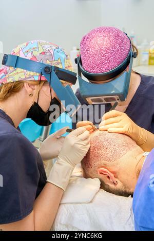 équipe médicale effectuant la greffe de cheveux ou la chirurgie de greffe de cheveux Banque D'Images