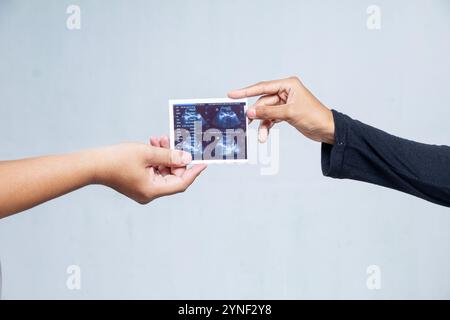 image de deux mains tenant des résultats d'échographie de grossesse isolés sur blanc, concept de parents en attente tenant bébé à naître Banque D'Images