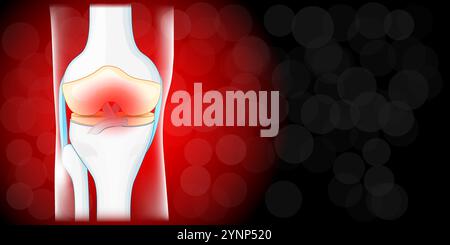 Douleurs articulaires du genou. Vue de face du genou humain. Maladie inflammatoire articulaire. Fond rouge foncé avec espace pour votre texte. Illustration vectorielle pour Presentat Illustration de Vecteur