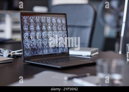 Plan d'arrière-plan de l'ordinateur portable des neurologues montrant l'imagerie tomodensitométrique du cerveau humain sur l'écran reposant sur la table de conférence dans le cabinet médical, sel Banque D'Images