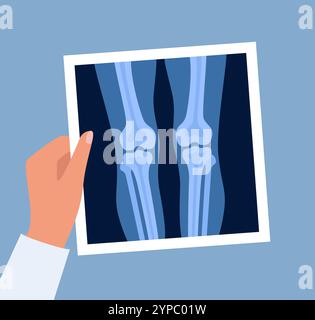 Radiographie des os et articulations du genou humain, examen et diagnostic. Roentgen abattu dans la main du médecin. Illustration vectorielle Illustration de Vecteur